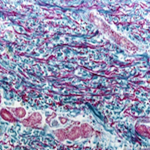 Rapid Turnaround Time